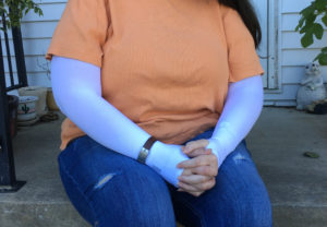 Mast Cell Activation Syndrome and Its Absurd Personal Impact 2